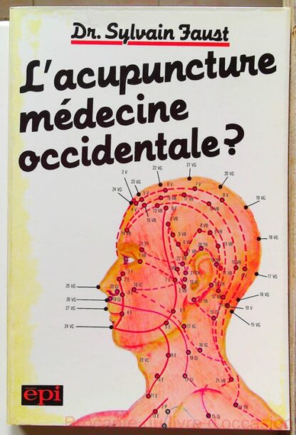 L'acupuncture, médecine occidentale ?