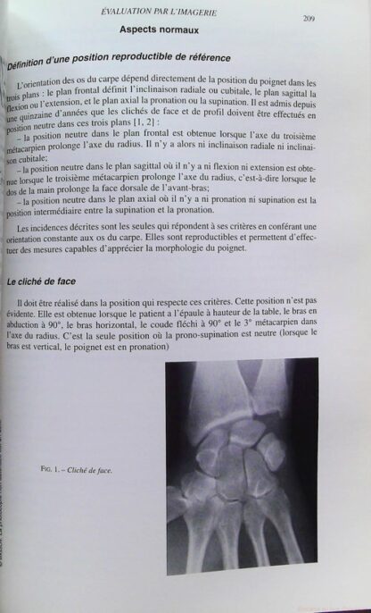 Pathologie traumatique du membre supèrieur chez le sportif. Convergences et divergences, 15eme journée de traumatologie du sport de la Pitie-Salpetriere – Image 8