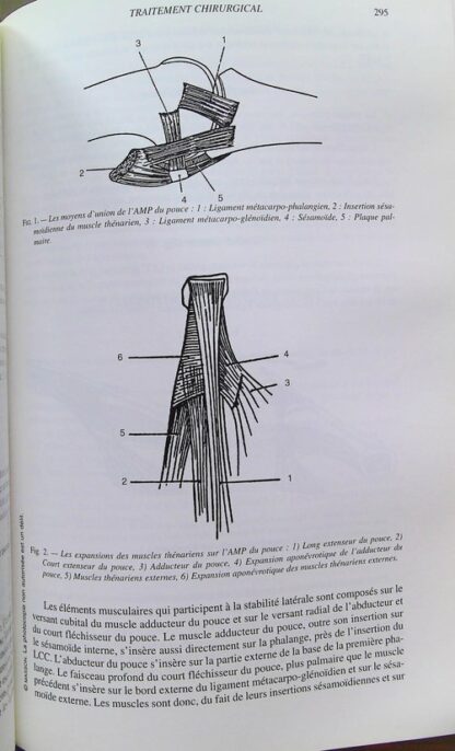 Pathologie traumatique du membre supèrieur chez le sportif. Convergences et divergences, 15eme journée de traumatologie du sport de la Pitie-Salpetriere – Image 9