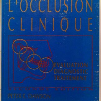 Les problèmes de l'occlusion clinique